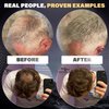 REJUVENATE Hair Fibers for Thinning Hair (Medium Brown), Undetectable Hair Powder for Men & 100% Natural Hair Building Fibers - Conceals Hair Loss - Bald Spot Cover Up Hair Powder, 2 Month Supply