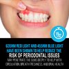 Starlite Smile Red Light Therapy Gum Light, Periodontal Light, Oral Care, Blue Light Therapy, Teeth Whitening Accelerator Light