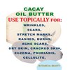 Botanical Beauty CACAY OIL BUTTER Pure Natural Virgin Unrefined RAW 8 Fl. Oz.- 240 ml for FACE SKIN BODY HAIR NAILS Vitamin C Vitamin E