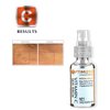 #1 BEST Anti Aging Vitamin C Serum with Vitamin E and Hyaluronic Acid, Medical Grade Skin Care For Face, Fill Fine Lines, Fades Age Spots, Evens Skin Tone, Anti Wrinkle OPTIMIZED for Day Use.