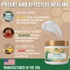 Green Leaf Naturals Manuka Honey Cream - Eczema Honey Cream (16oz) Moisturizer Lotion - Ultra Soothing Relief - Face & Body Care, Itchy, Dry Skin Rash Healing Ointment - For Adults & Kids