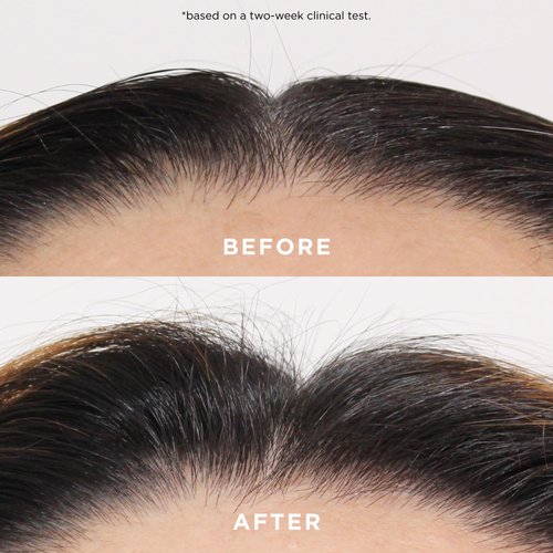 Dr. Groot Hair Thickening Shampoo with Biotin, Rosemary Oil for Volumizing Thinning, Damaged Hair - Hydrating Korean Kbeauty Scalp Revitalizing Solution