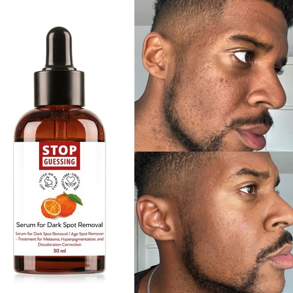 The Fast Dark Spot Remover Serum for Face by Stop Guessing