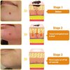 iYanoc 2 PCS Bee Venom Cream, Professional Bee Venom Repair Cream, New Bee Venom Treatment Cream, Hydrating Moisturizing Cream for Men and Women, Suitable for All Skin Types