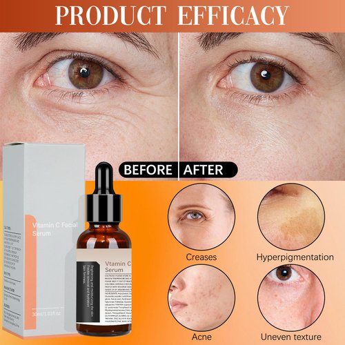 2 PCS Vitamin C Facial Serum Essence, Skin Care, Hydration, Skin Moisturized, 30 ml, 1.01oz