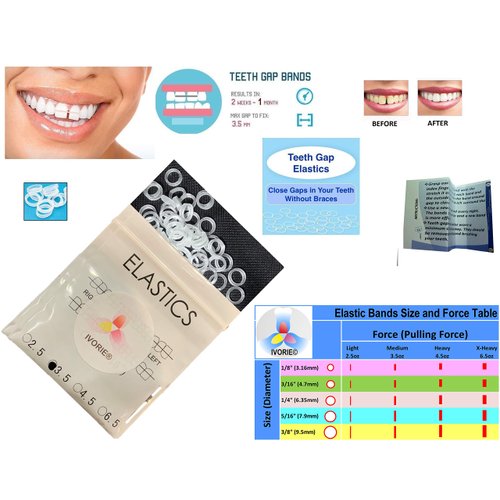 IVORIE Dental Cosmetic Ortho Elastic Rubber Bands Braces Teeth Gap Alignment 80pcs (3/8" Monkey 4.5oz (High))