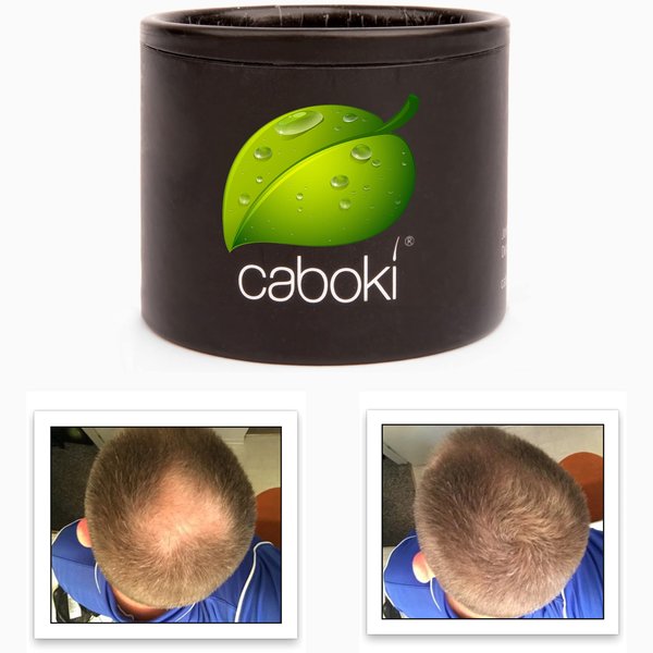 Quick Fix For Thinning Hair and Bald Spot. Get 10X Fuller Hair Instantly. All-Natural Hair Building Fiber For Hair. Trial Size (10-Day Supply). Light Brown