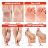 Lavinso Peach Foot Peel Mask for Dry Cracked Feet - 4 Pack - Dead Skin Remover Foot Mask for Cracked Feet and Callus - Exfoliating Feet Peeling Mask for Soft Baby Feet