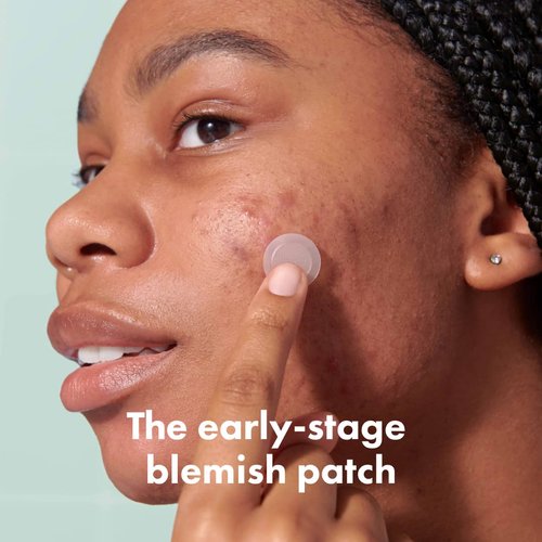 Mighty Patch Micropoint™ for Blemishes from Hero Cosmetics - Hydrocolloid Acne Spot Treatment Patch for Early Stage Zits and Hidden Pimples, 395 Proprietary Micropoints (8 Patches)