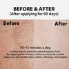Lululun 32pcs Facial Sheet Mask, Moisturizing Face Mask Sheet & Anti Aging Face Mask Pack Set for Beauty Skincare, PRECIOUS RED
