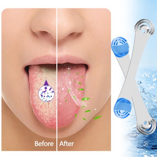 Tongue Scraper,Silicone Tongue Cleaner for Adults,Kids,Reduce Bad Breath,Oral Care,Reusable Tongue Brush for Fresh Breath,Oral Hygiene,Easy to Use,2pcs Replacement Pads (Blue)